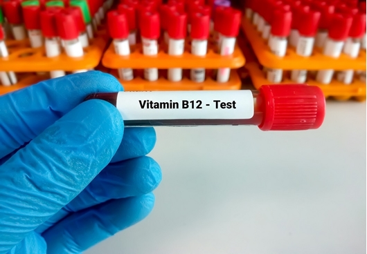 Picture of VITAMIN B12 TEST
