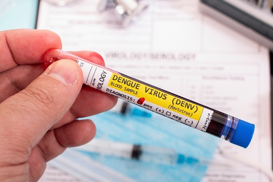 Picture of DENGUE TEST